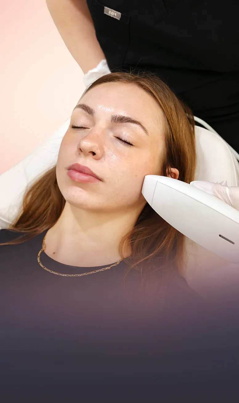 Nanofractional RF – Venus Viva™ treatment at Toronto medical spa - Viva™ RF resurfaces facial skin to fade scars, por...