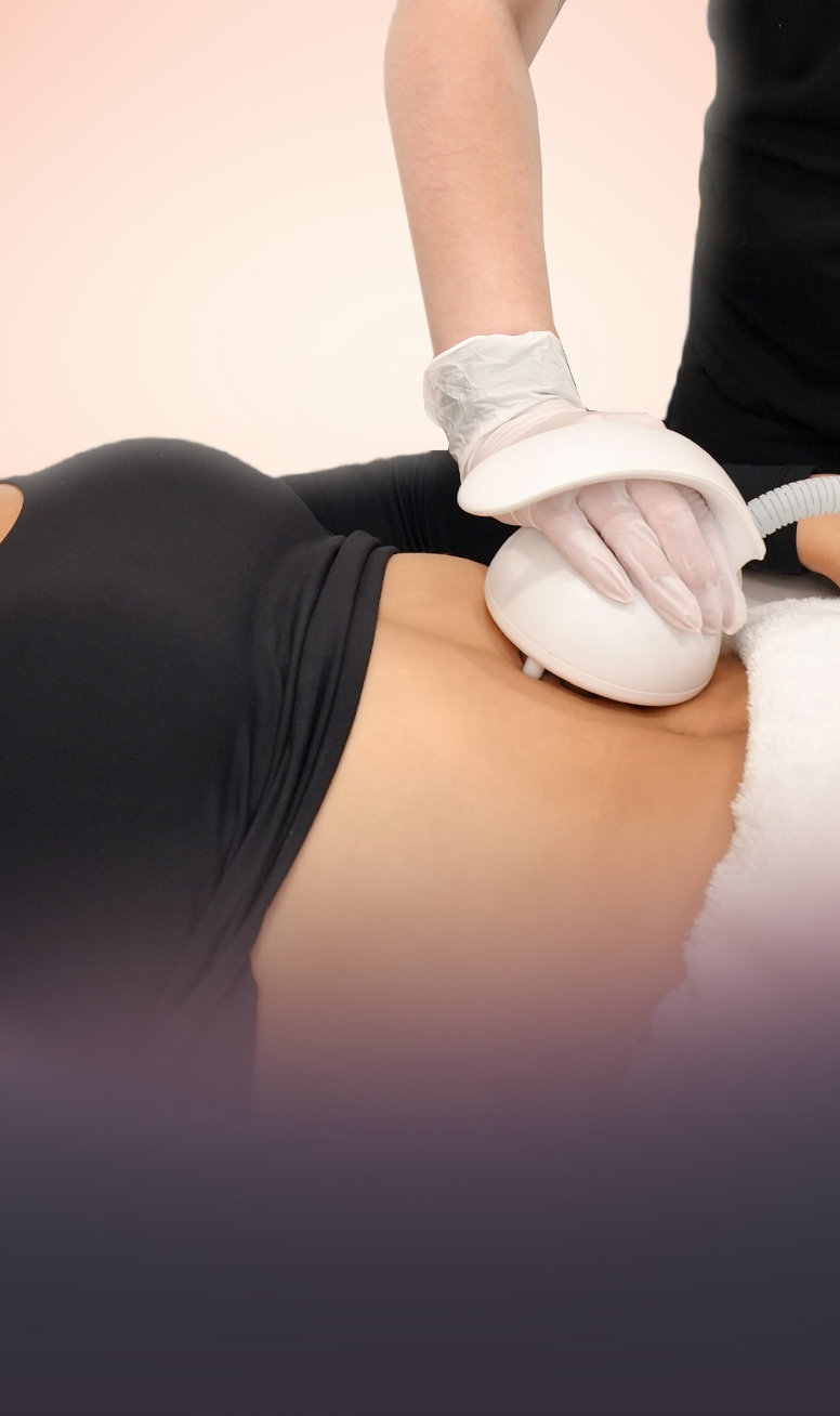 Venus OctiPolar™ Fat Reduction & Body Contouring treatment at Toronto medical spa - OctiPolar™ tightens skin and reduces fat and cellu...